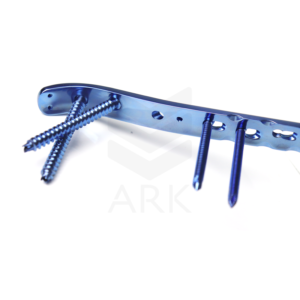 PLACA FÉMUR PROXIMAL 4.9 Y 7.3 MM LCP TITANIO